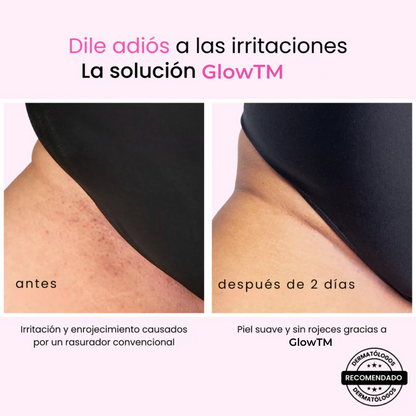 GlowTM | Depiladora PRO